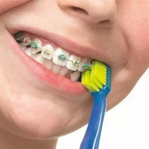 CURAPROX ORTHO 3 1