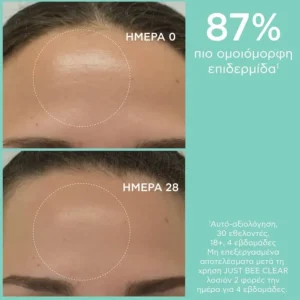 apivita JUST BEE CLEAR BEFORE AFTER LOTION 1 1