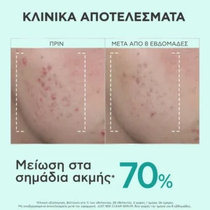 APIVITA Just Bee Clear Serum Ορός Λείανσης για Ατέλειες & Σημάδια Ακμής - 30ml